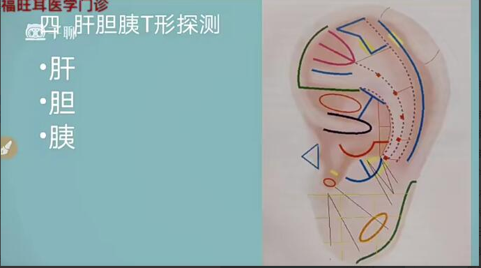 张福旺精讲耳穴诊断班